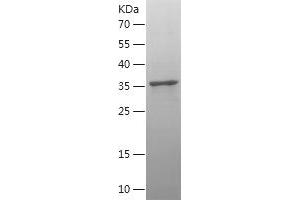 Western Blotting (WB) image for Cytochrome C Oxidase Subunit II (COX2) (AA 104-209) protein (His-IF2DI Tag) (ABIN7122571) (COX2 Protein (AA 104-209) (His-IF2DI Tag))