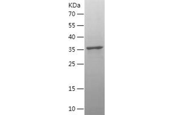 COX2 Protein (AA 104-209) (His-IF2DI Tag)
