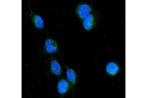 IF analysis of RHOB using anti-RHOB antibody (ABIN6719538).
