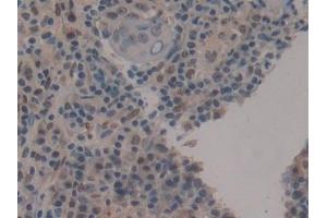 Immunohistochemistry (IHC) image for anti-Cold Inducible RNA Binding Protein (CIRBP) (AA 1-172) antibody (ABIN7442150)