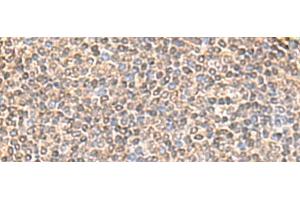 Immunohistochemistry of paraffin-embedded Human tonsil tissue using IQCD Polyclonal Antibody at dilution of 1:60(x200) (IQCD Antikörper)