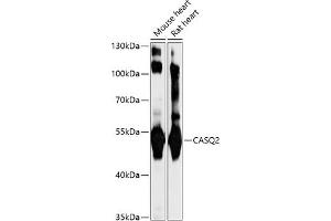 Western blot analysis of extracts of various cell lines, using C antibody (ABIN7266047) at 1:1000 dilution. (CASQ2 Antikörper  (AA 20-399))