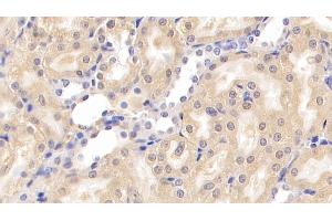Detection of NPHN in Rat Kidney Tissue using Monoclonal Antibody to Nephrin (NPHN) (Nephrin Antikörper  (AA 39-106))