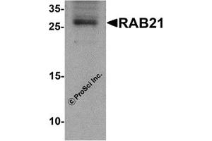Western Blotting (WB) image for anti-RAB21, Member RAS Oncogene Family (RAB21) (C-Term) antibody (ABIN1030610) (RAB21 Antikörper  (C-Term))