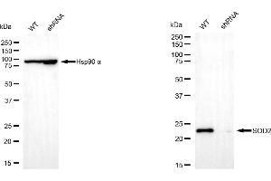 Western blotting analysis using superoxide dismutase 2 antibody (ABIN7800462).