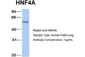 Western Blotting (WB) image for anti-Hepatocyte Nuclear Factor 4, alpha (HNF4A) (N-Term) antibody (ABIN2777514)