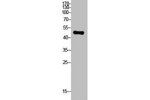 Western Blot analysis of HepG2 cells using Acetyl-PTEN (K402) Polyclonal Antibody (PTEN Antikörper  (acLys402))