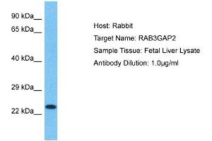 Host: Rabbit Target Name: RAB3GAP2 Sample Type: Fetal Liver lysates Antibody Dilution: 1. (RAB3GAP2 Antikörper  (Middle Region))