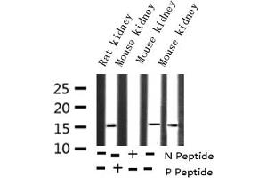 Western Blotting (WB) image for anti-Baculoviral IAP Repeat-Containing 5 (BIRC5) (pThr117) antibody (ABIN6255588)