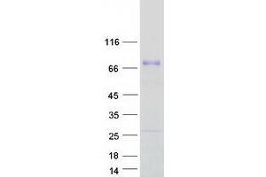 Validation with Western Blot (ACBD5 Protein (Transcript Variant 1) (Myc-DYKDDDDK Tag))