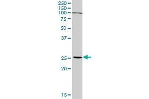 IFNA2 MaxPab rabbit polyclonal antibody. (IFNA2 Antikörper  (AA 1-188))