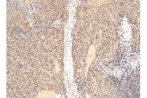 Immunohistochemistry (IHC) image for anti-Ionized Calcium-binding Adapter Molecule 1 (IBA1) (C-Term) antibody (ABIN184738)