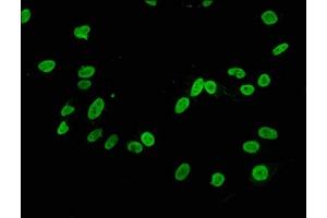 Immunofluorescence staining of Hela cells with ABIN7127289 at 1:34,counter-stained with DAPI. (Rekombinanter HIST1H3A Antikörper  (H3K4me2))