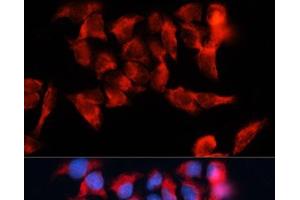 Immunofluorescence analysis of HeLa cells using BST2 Polyclonal Antibody at dilution of 1:100. (BST2 Antikörper)