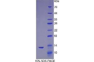 SDS-PAGE analysis of Mouse Nephrin Protein. (Nephrin Protein)