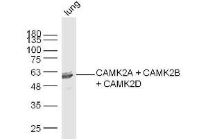 Mouse lung lysates probed with CAMK2A + CAMK2B + CAMK2D Polyclonal Antibody, Unconjugated  at 1:300 dilution and 4˚C overnight incubation. (CAMK2B Antikörper  (AA 1-100))