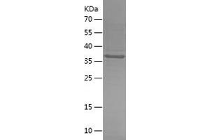 Western Blotting (WB) image for Acyl-CoA Thioesterase 13 (ACOT13) (AA 1-140) protein (His-IF2DI Tag) (ABIN7121685) (THEM2 Protein (AA 1-140) (His-IF2DI Tag))