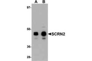 Western blot analysis of SCRN2 in 293 cell tissue lysate with SCRN2 antibody at (A) 0. (SCRN2 Antikörper  (C-Term))