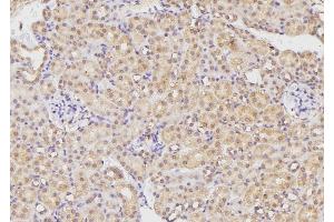 ABIN6269280 at 1/100 staining Mouse kidney tissue by IHC-P. (BMX Antikörper  (C-Term))