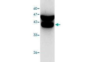 Western blot analysis of SW480 whole cell lystae with CDC42 monoclonal antibody, clone 1  at 1:1000 dilution.