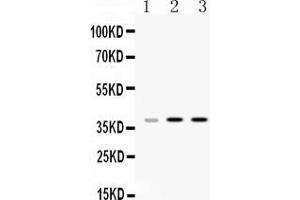 Western blot analysis of HnRNP A1 expression in rat liver extract ( Lane 1), mouse thymus extract ( Lane 2) and HELA whole cell lysates ( Lane 3).