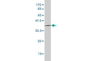 Western Blot detection against Immunogen (35. (LHX6 Antikörper  (AA 274-363))