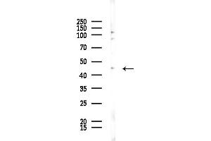 anti-Mitochondrial Ribosomal Protein S31 (MRPS31) (Internal Region) antibody
