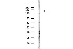anti-Polymerase (RNA) III (DNA Directed) Polypeptide B (POLR3B) (C-Term) antibody