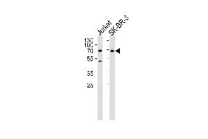 Western blot analysis of lysates from Jurkat,SK-BR-3 cell line (from left to right),using CD46 Antibody . (CD46 Antikörper  (C-Term))