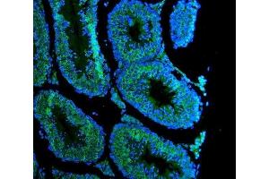 IF analysis of DDX4 using anti-DDX4 antibody (ABIN7601203).