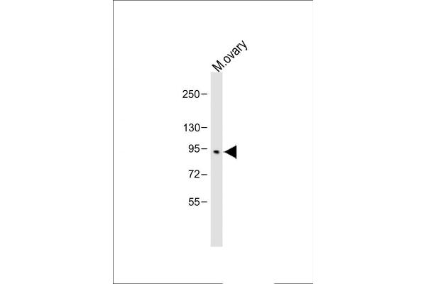 BAP1 Antikörper  (AA 36-66)