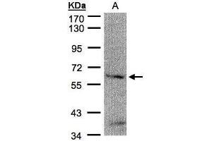 WB Image Sample(30 μg of whole cell lysate) A:H1299 7. (FANCG Antikörper  (Center))