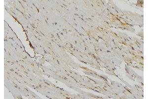 ABIN6274718 at 1/100 staining Mouse muscle tissue by IHC-P.