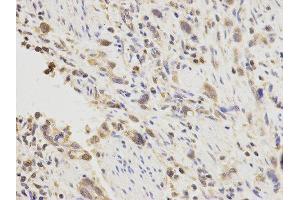 Immunohistochemistry (IHC) image for anti-Placenta Growth Factor (PGF) antibody (ABIN1874109) (PLGF Antikörper)