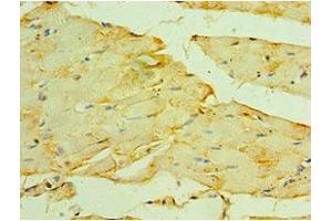 Immunohistochemistry of paraffin-embedded human skeletal muscle tissue using ABIN7160621 at dilution of 1:100 (Myotilin Antikörper  (AA 443-498))