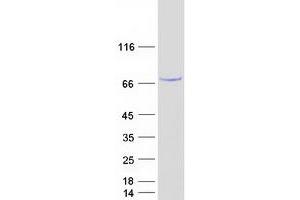 Validation with Western Blot