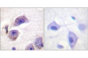 Immunohistochemistry (IHC) image for anti-PTK2 Protein tyrosine Kinase 2 (PTK2) (AA 373-422), (pTyr407) antibody (ABIN1531316)