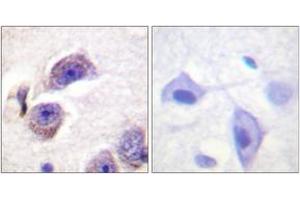 Immunohistochemistry analysis of paraffin-embedded human brain, using FAK (Phospho-Tyr407) Antibody. (FAK Antikörper  (pTyr407))