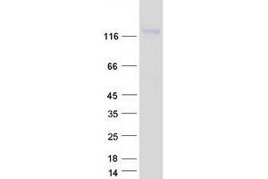 Western Blotting (WB) image for Leucyl/cystinyl Aminopeptidase (LNPEP) (Transcript Variant 1) protein (Myc-DYKDDDDK Tag) (ABIN2724857)