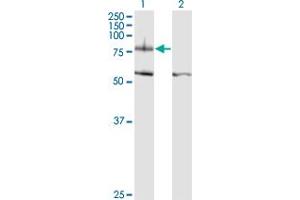 Western Blot analysis of ITGB8 expression in transfected 293T cell line by ITGB8 monoclonal antibody (M01), clone 2B4.