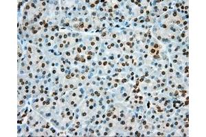 Immunohistochemical staining of paraffin-embedded Kidney tissue using anti-PRKG1 mouse monoclonal antibody. (PRKG1 Antikörper)