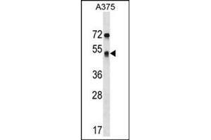 Western blot analysis of SEPT11 Antibody (Center) Cat. (Septin 11 Antikörper  (Middle Region))