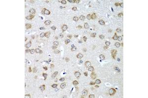 Immunohistochemistry of paraffin-embedded mouse brain using EIF1AX antibody (ABIN5973507) at dilution of 1/100 (40x lens). (EIF1AX Antikörper)