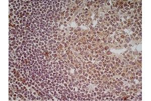 Immunoperoxidase staining of a human tonsil cryosection with Mouse anti Human CD70 antibody, clone Bu69 followed by the Histar setection system. (CD70 Antikörper)