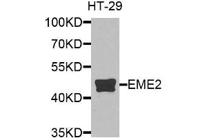 Western blot analysis of extracts of HT-29 cells, using EME2 antibody. (EME2 Antikörper)