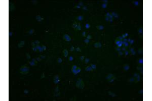 Immunofluorescence staining of PC3 cells with ABIN7163924 at 1:200, counter-stained with DAPI. (KCNK15 Antikörper  (AA 244-330))