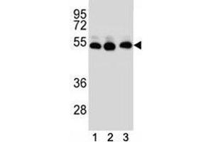 TUBB2B antibody western blot analysis of (1) HepG2, (2) HeLa, (3) MDA-MB231 lysate