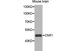 Western blot analysis of extracts of mouse brain cells, using CNR1 antibody. (CNR1 Antikörper)