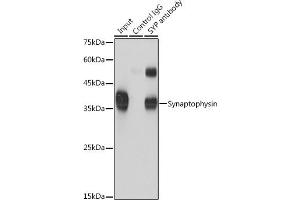Immunoprecipitation analysis of 600 μg extracts of Mouse brain cells using 3 μg Synaptophysin antibody (ABIN6135349, ABIN6148783, ABIN6148784 and ABIN6221958). (Synaptophysin Antikörper  (AA 150-250))