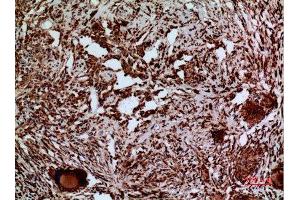 Immunohistochemistry (IHC) analysis of paraffin-embedded Human Lung, antibody was diluted at 1:100.
